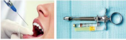 胰島素，牙科麻醉6.png